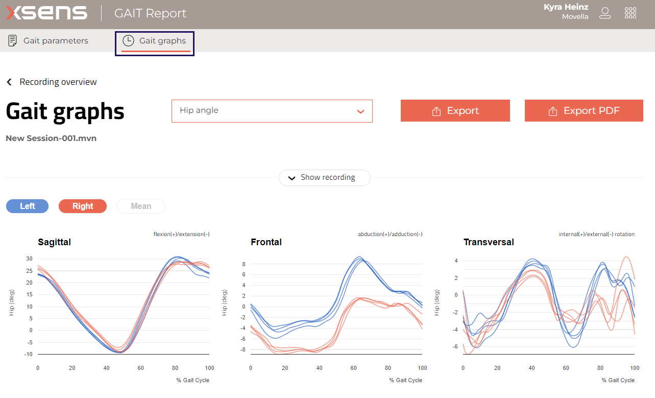 Gait Report - How to interpret the data?